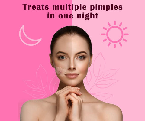 Urban Yog Rectangular Pimple Patch- 4 Rectangular Invisible Facial Stickers coveR