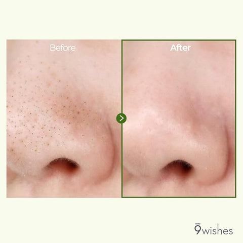 9Wishes Amazing Pore Ampule Serum 25ml