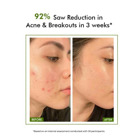 Conscious Chemist 2% Salicylic Acid Face Wash | 100ml