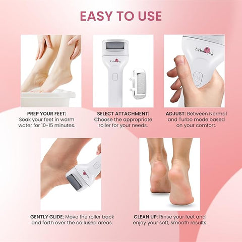UrbanYog Callus Remover