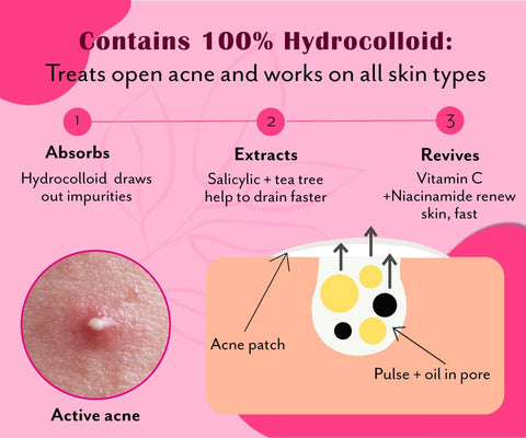 Urban Yog Rectangular Pimple Patch- 4 Rectangular Invisible Facial Stickers coveR
