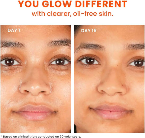 Foxtale Pearlfection Oil Balancing Moisturizer - 50 ml