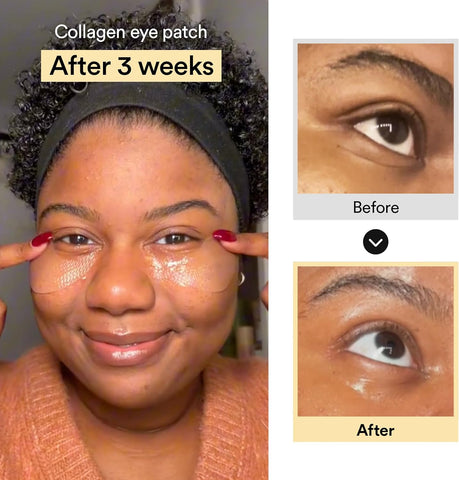 ABIB Collagen Eye Patch