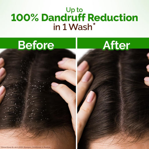 Mamaearth Lemon Anti-Dandruff Shampoo 250 ml