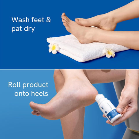 Bebodywise 20% Urea Foot Roll-On 75Ml