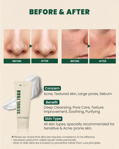 K-SECRET SEOUL 1988 Cleansing Foam : Pine Cica 1% + Probiotics