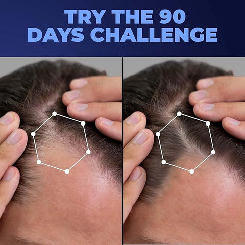 Beardo Advanced Hair Growth Serum 50Ml